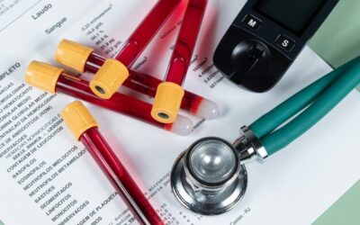 Jakie badania krwi zrobić na keto i o czym mogą świadczyć wyniki?